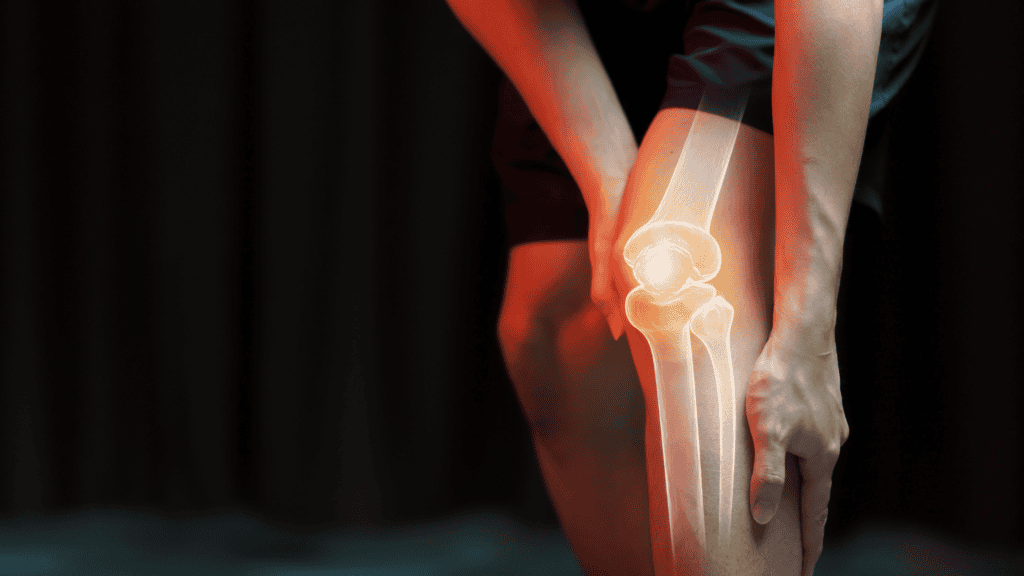 Jumper’s Knee Treatment: Load Management for Patellar Tendon Pain