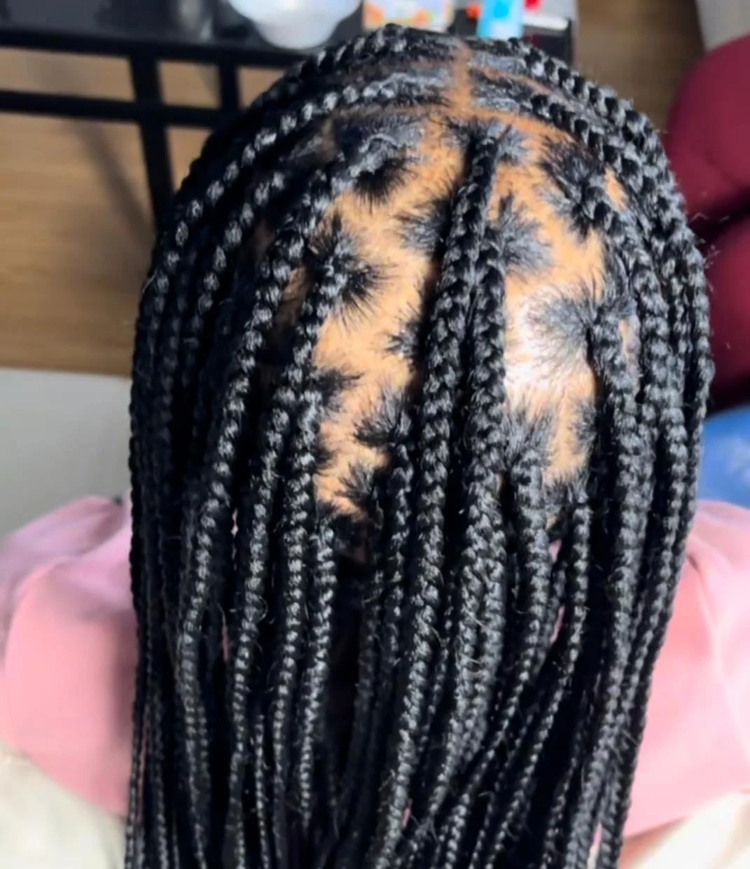 Close-up of a person's head with black and gray braided hair, showing the roots and scalp.