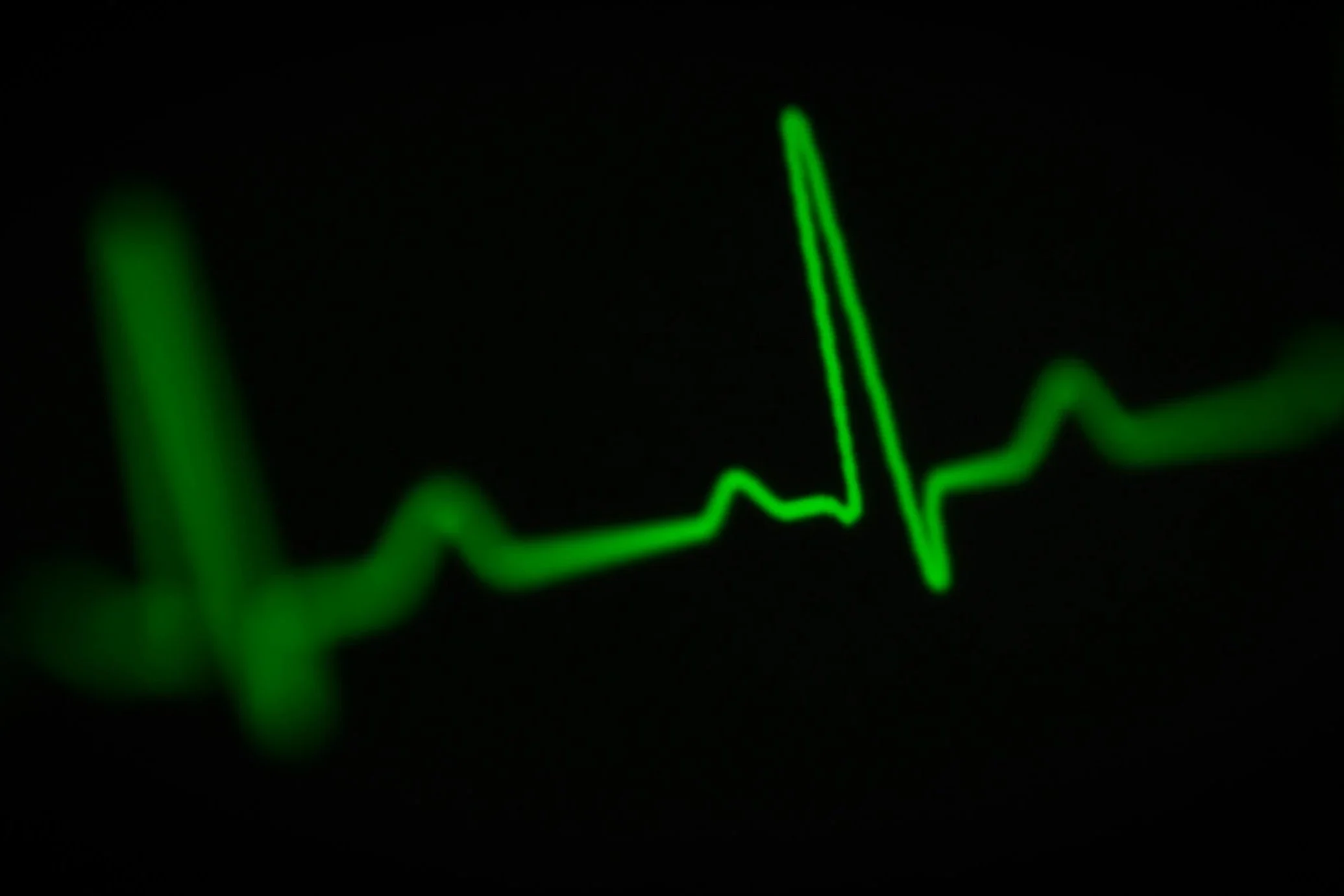Heart Rate Zones for Runners