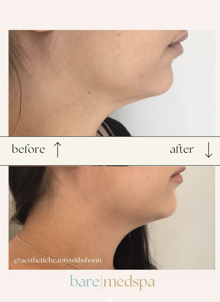 Screen Shot 2023-08-31 at 4.09.32 PM.png