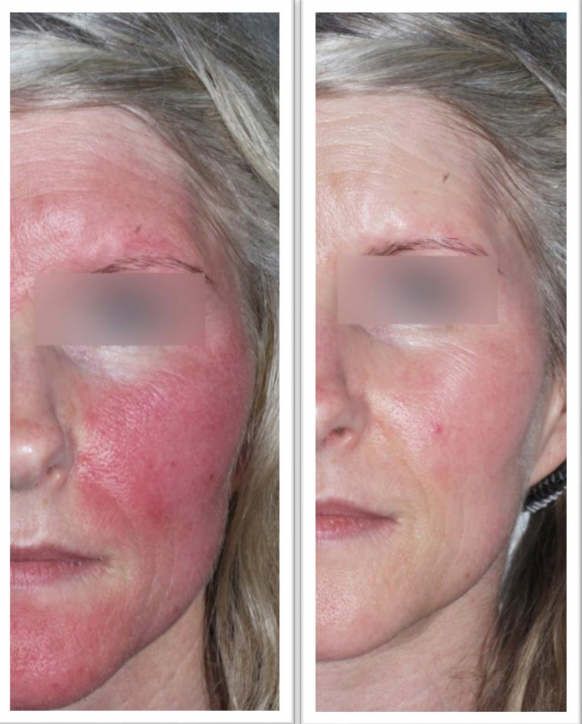 Screen Shot 2023-11-03 at 8.54.35 AM.png