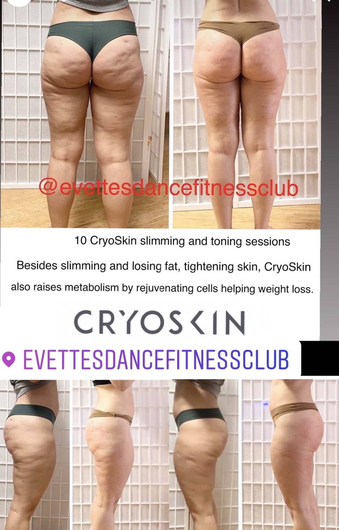 CryoSkin — Evettes Dance Fitness Club