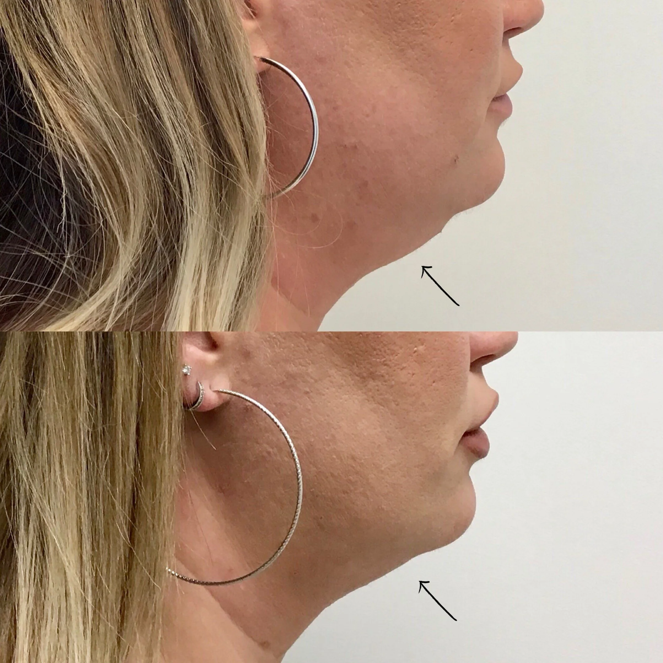 Belkyra - female .jpeg