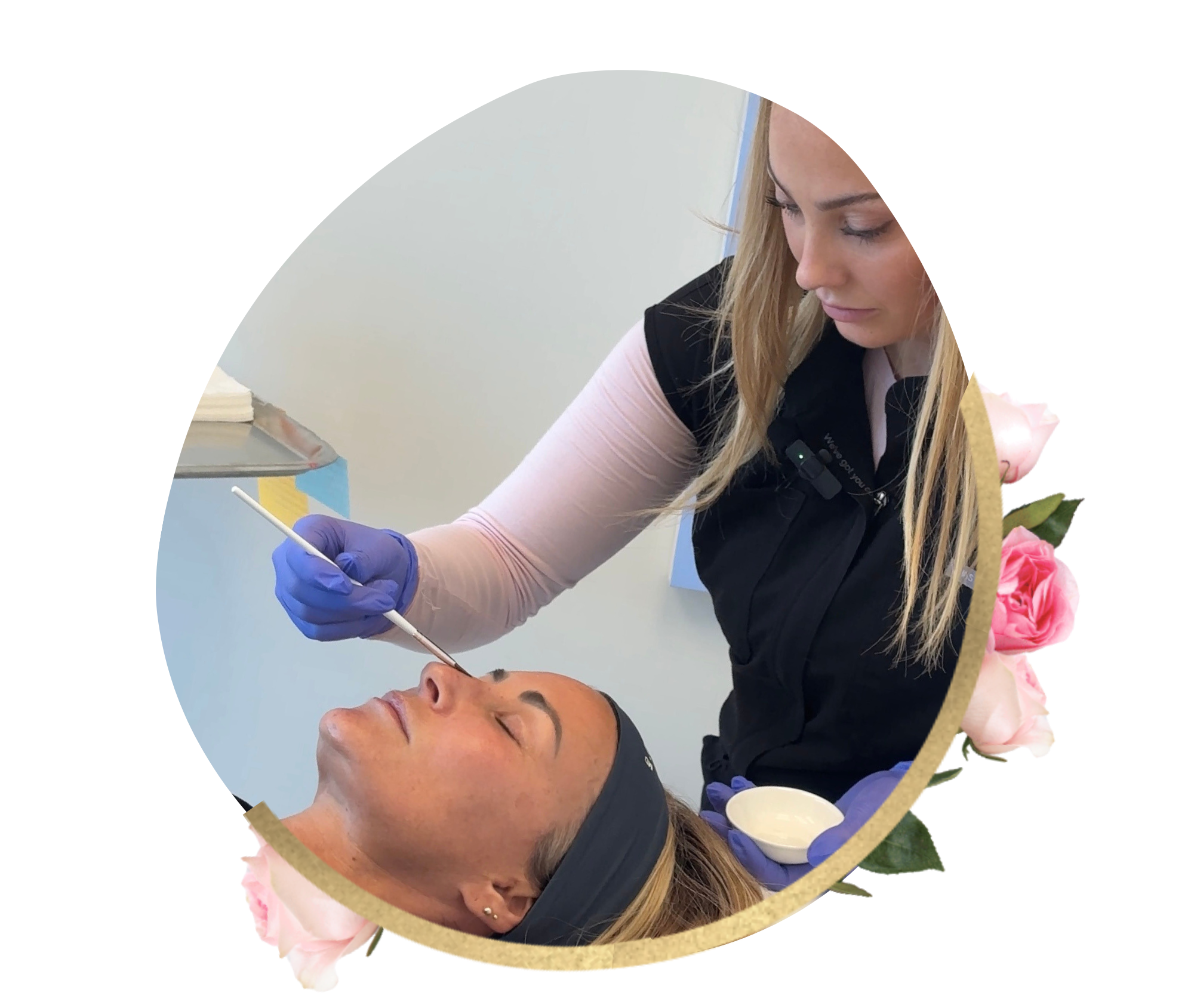 Medical-Grade Chemical Peels