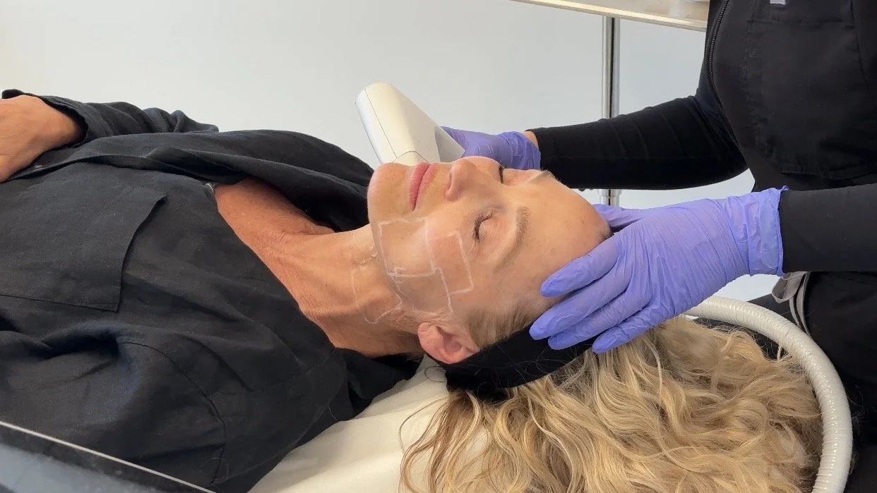 A woman receiving sofwave treatment at PHI Medical Aesthetics