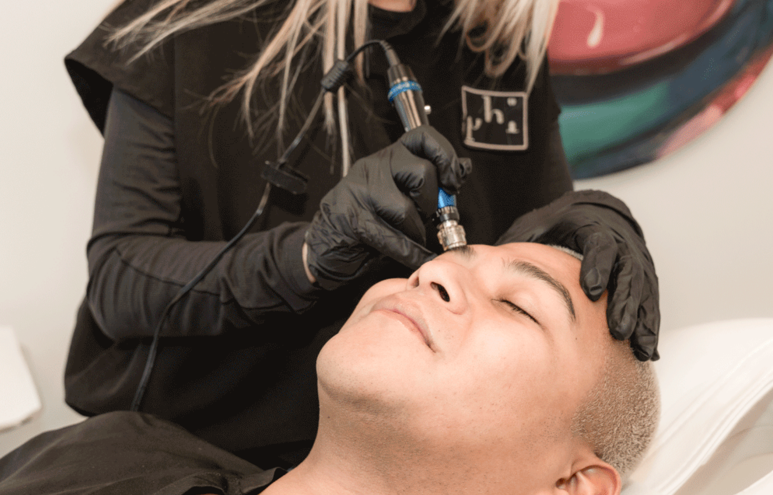 Person receiving microneedling treatment at PHI Medical Aesthetics