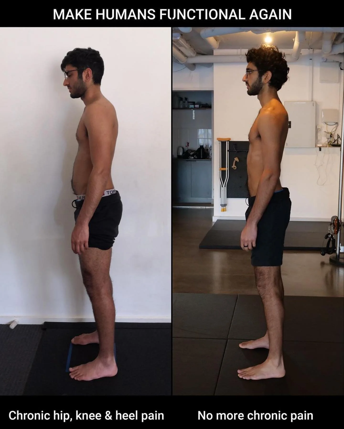 #Repost @davidfilonzi
・・・
POSTURE GAINS
Some progress from one of my clients @harmanhundel training out @fp_melbourne. Getting rid of chronic pain one human at a time. Thanks for the trust and putting in the work 👊
Before:
-Inflamed gut
-Chronic k