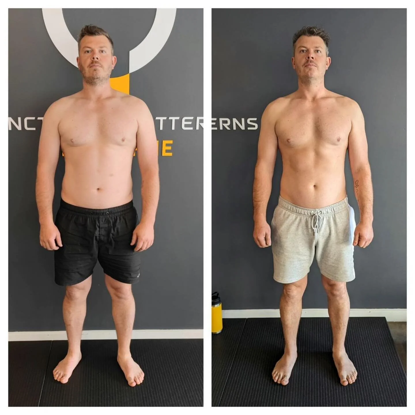 *SCOLIOSIS, PAIN AND WEIGHT LOSS IMPROVEMENTS*. Great work here from our practitioner @steve_pitros and his client Ben @yolebennyole
Before:  October 2022
After: July 2023
Weight before: 117kg
Weight after: 98kg
Testimonial: I am a plumber by trad