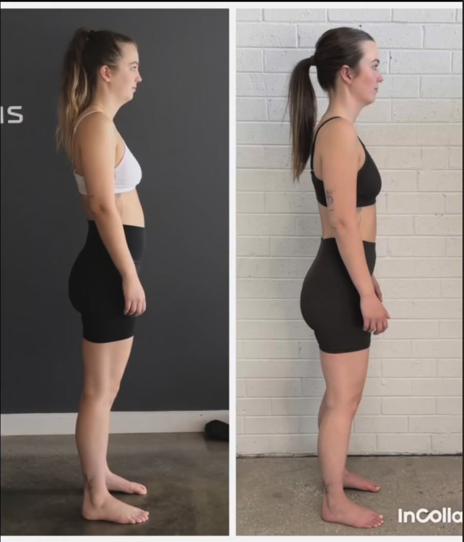 Unlock Your Best Posture: Effective Back Exercises for Bad Posture