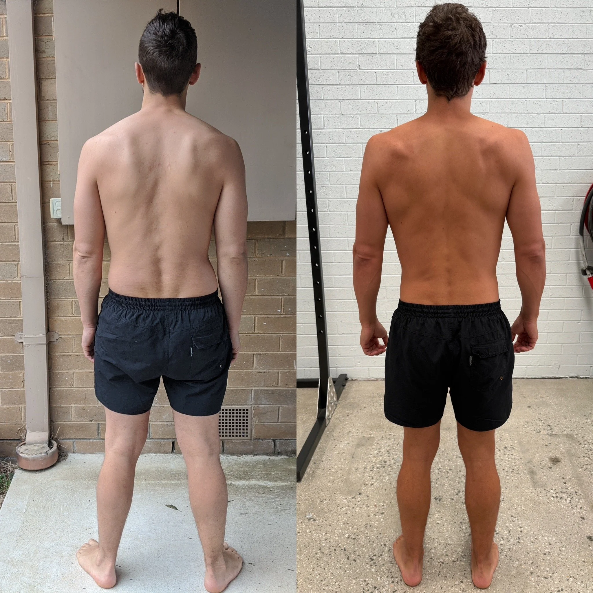 Before and after posture correction showing improved spinal alignment and reduced back pain