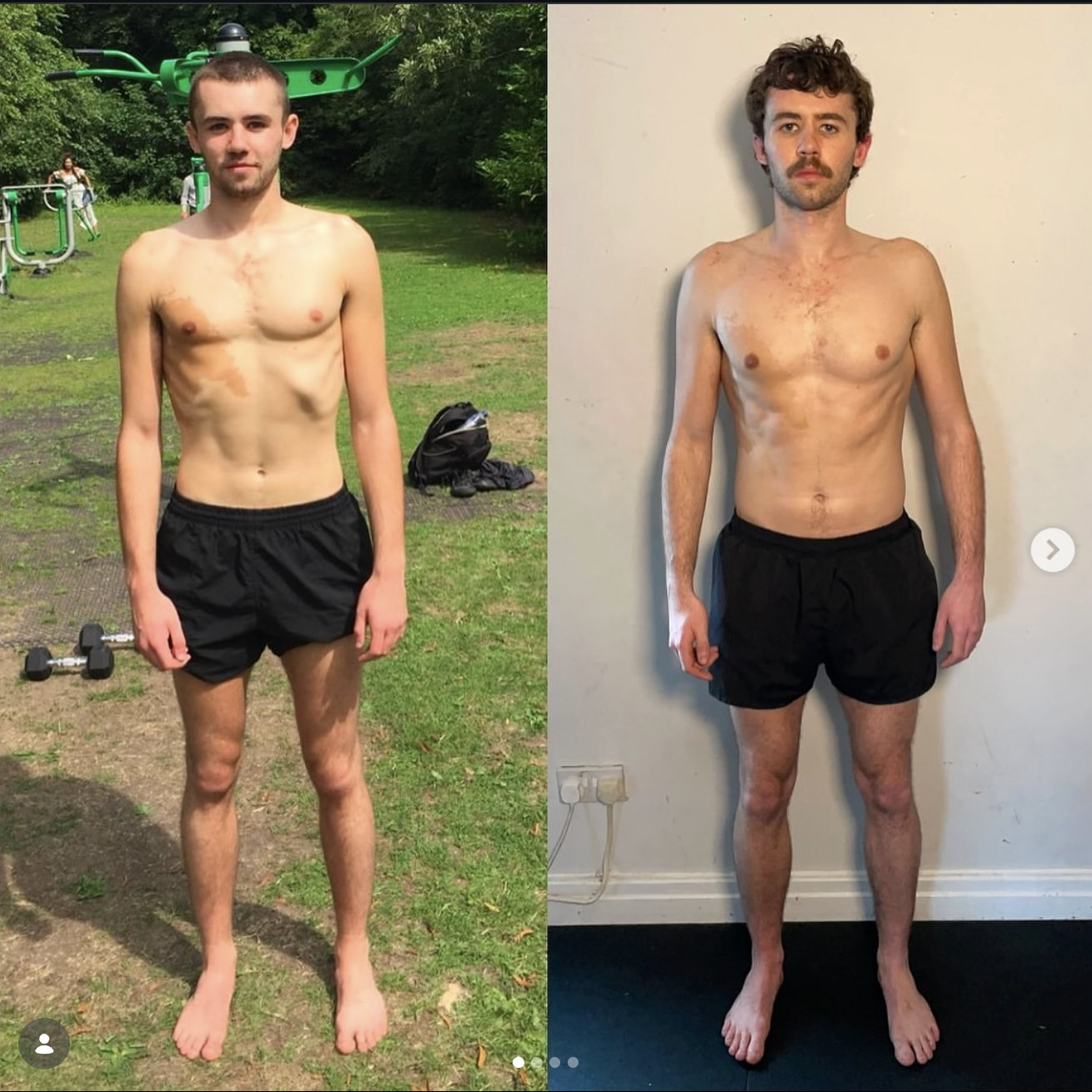 Rib Flare and Posture: How Functional Patterns Restores Your Body