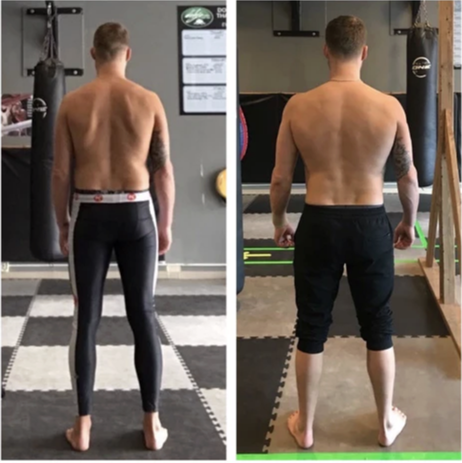 Before and after posture and mobility improvement with Functional Patterns Melbourne exercises