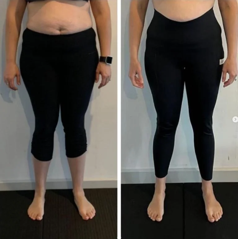 Side-by-side image of feet before and after structural training