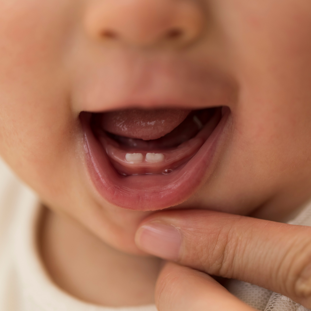 Misconceptions About Baby Teeth Care: What Every Parent Should Know