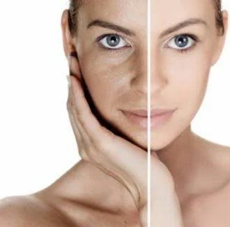DermaRenew