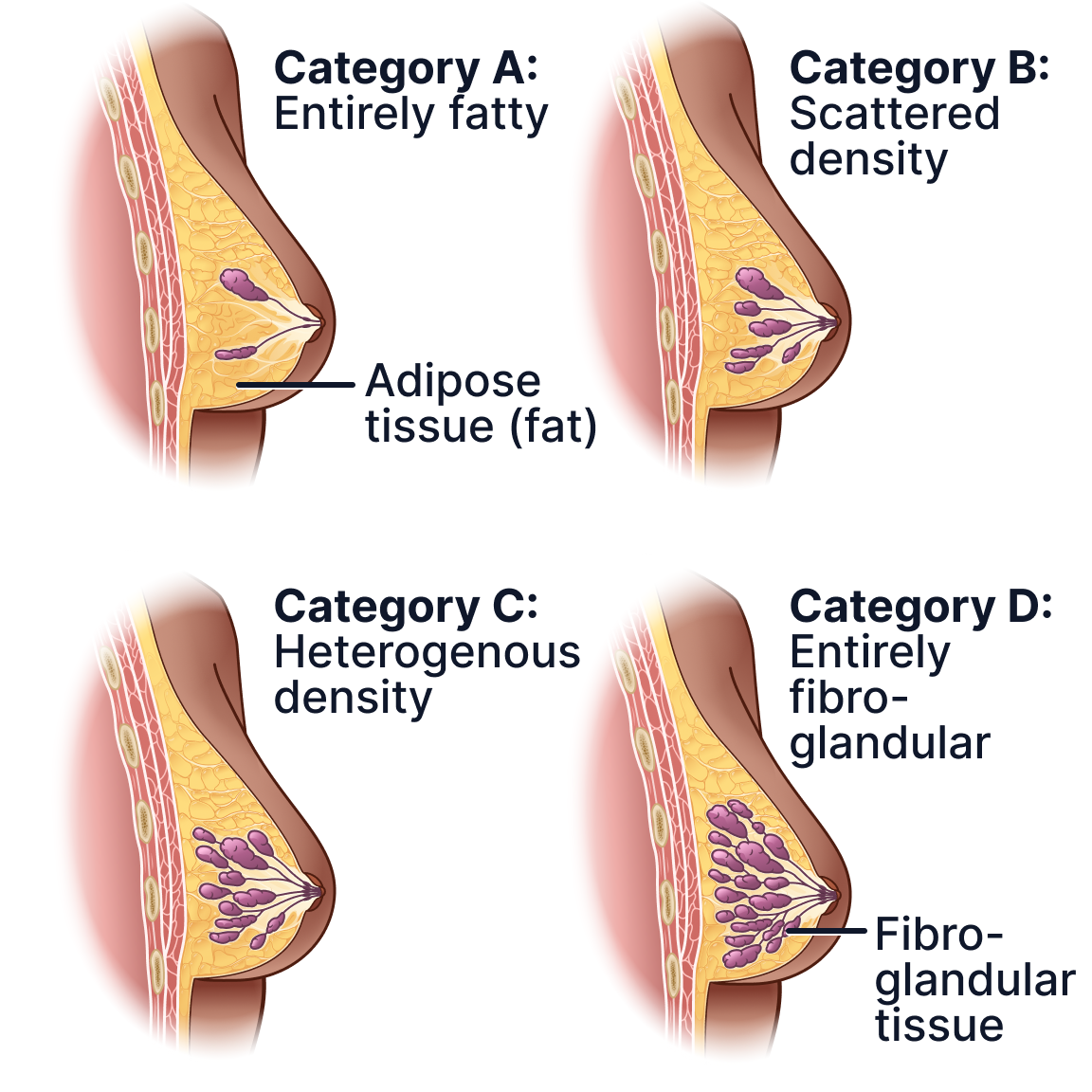 Breast Densities.png
