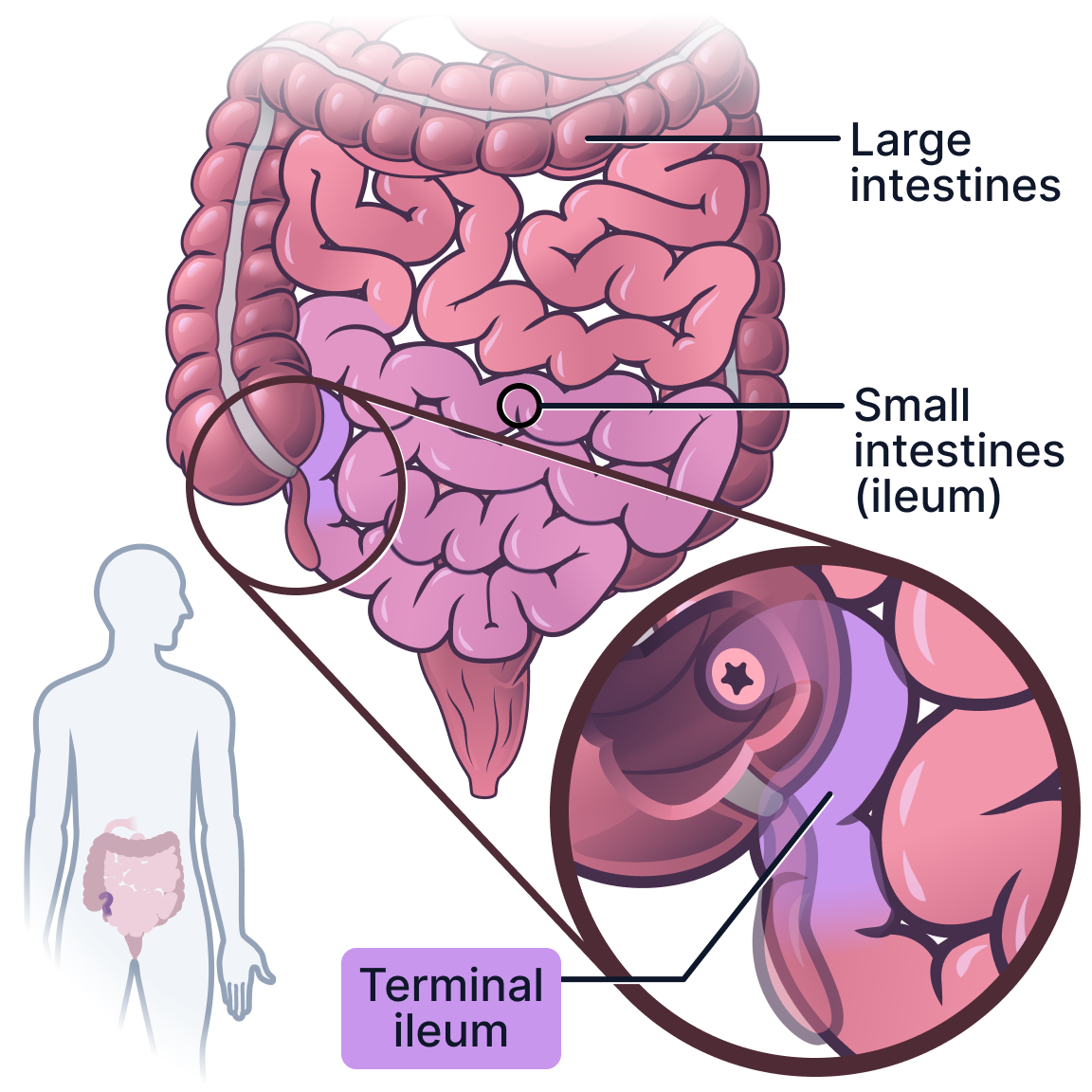 Terminal ileum.png