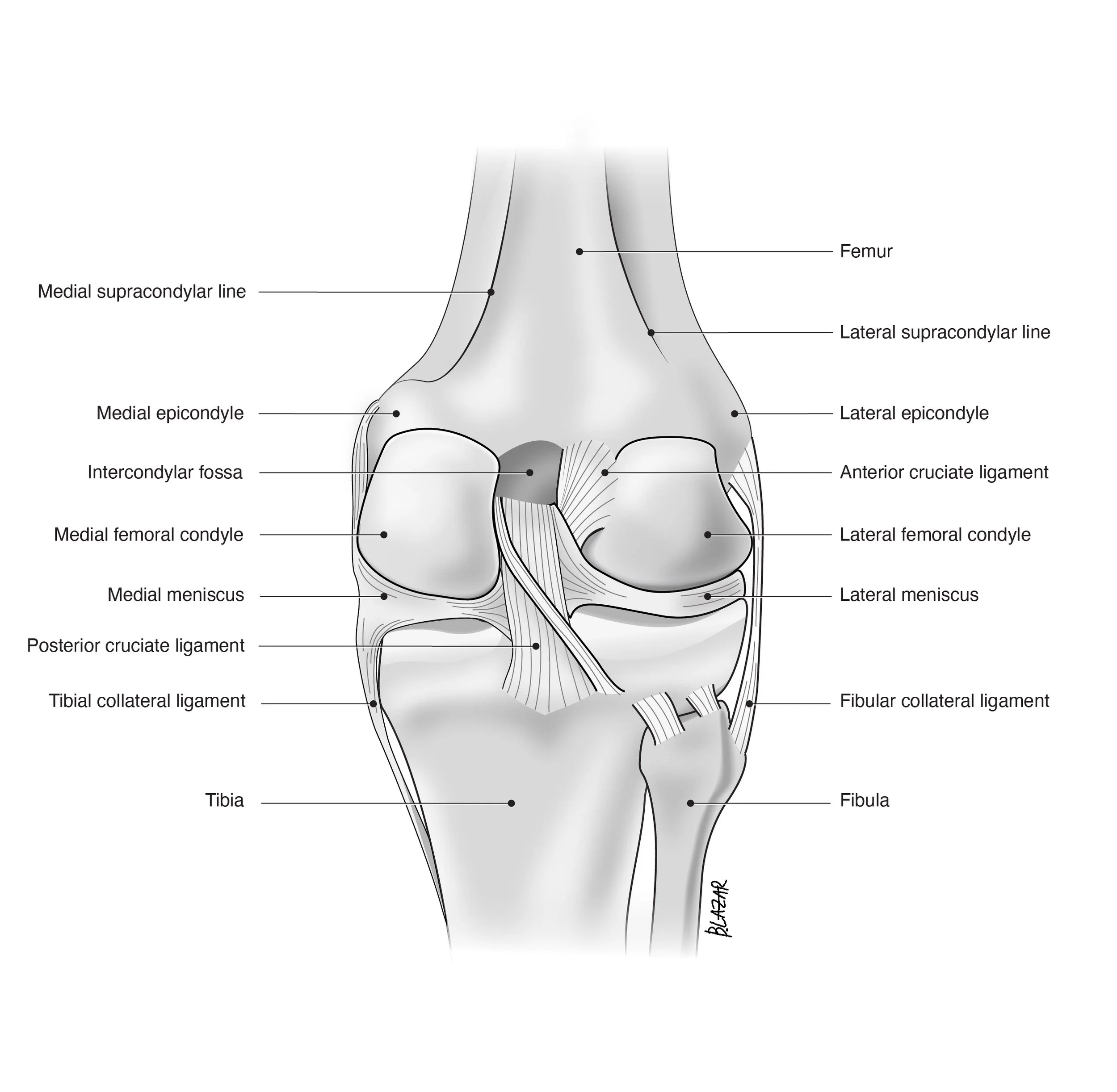 Diagram of a human knee joint showing bones, ligaments, and cartilage with labels indicating femur, tibia, fibula, medullary epicondyle, lateral epicondyle, medial epicondyle, lateral meniscus, medial meniscus, anterior cruciate ligament, posterior c