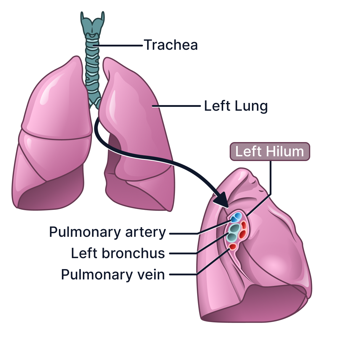 Left Lung Hilum.png