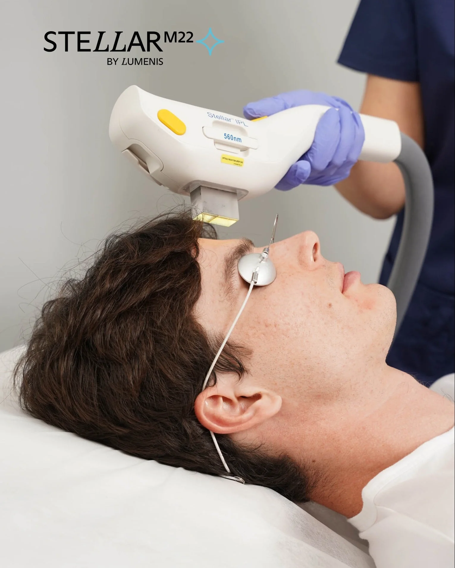 A woman undergoing a facial treatment in a spa or clinic, wearing protective eye goggles and with a skincare device on her face.