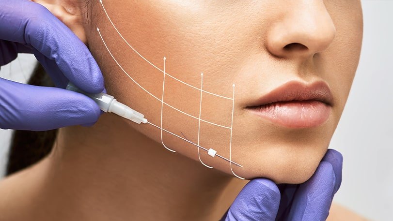 A woman receives a cosmetic facial injection, with dotted lines indicating a change in facial contour.