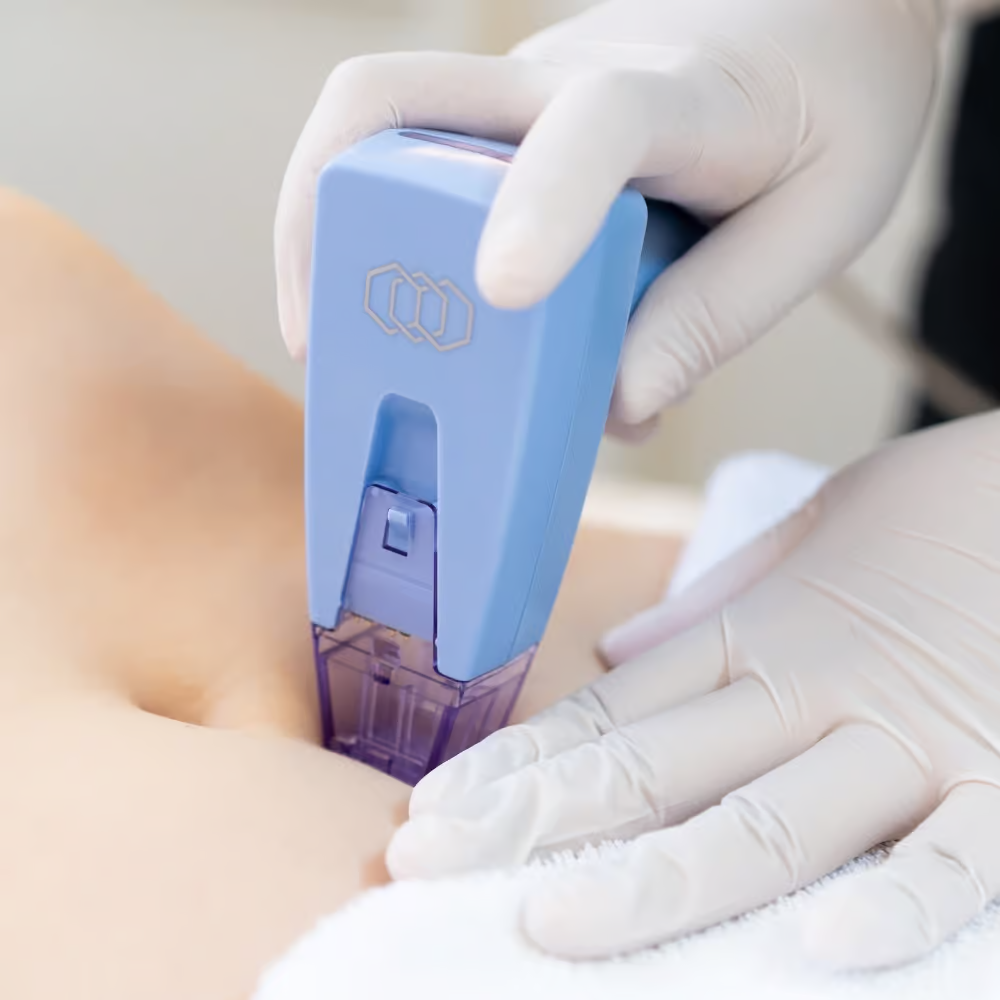 body contouring in tampa