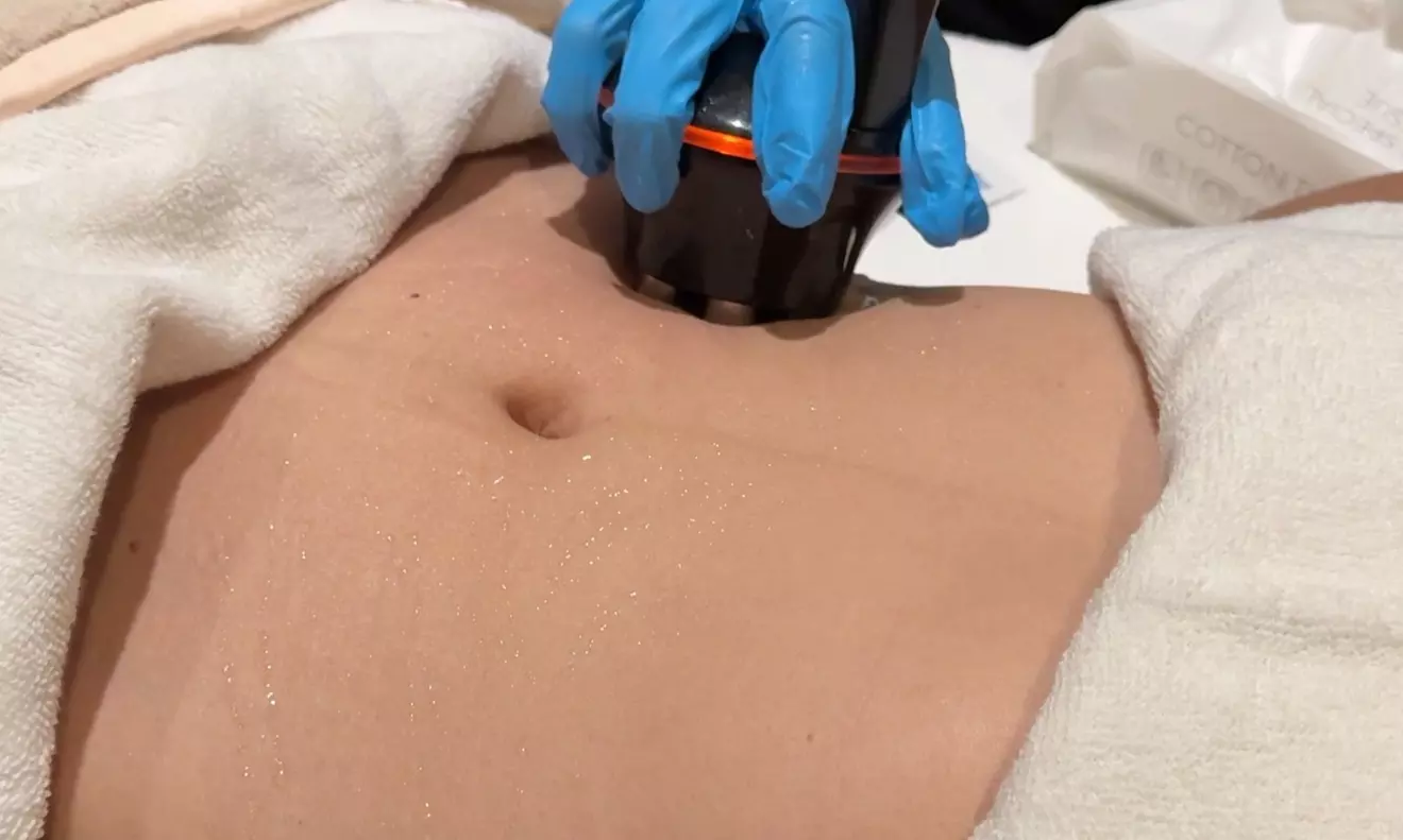 body contouring tampa