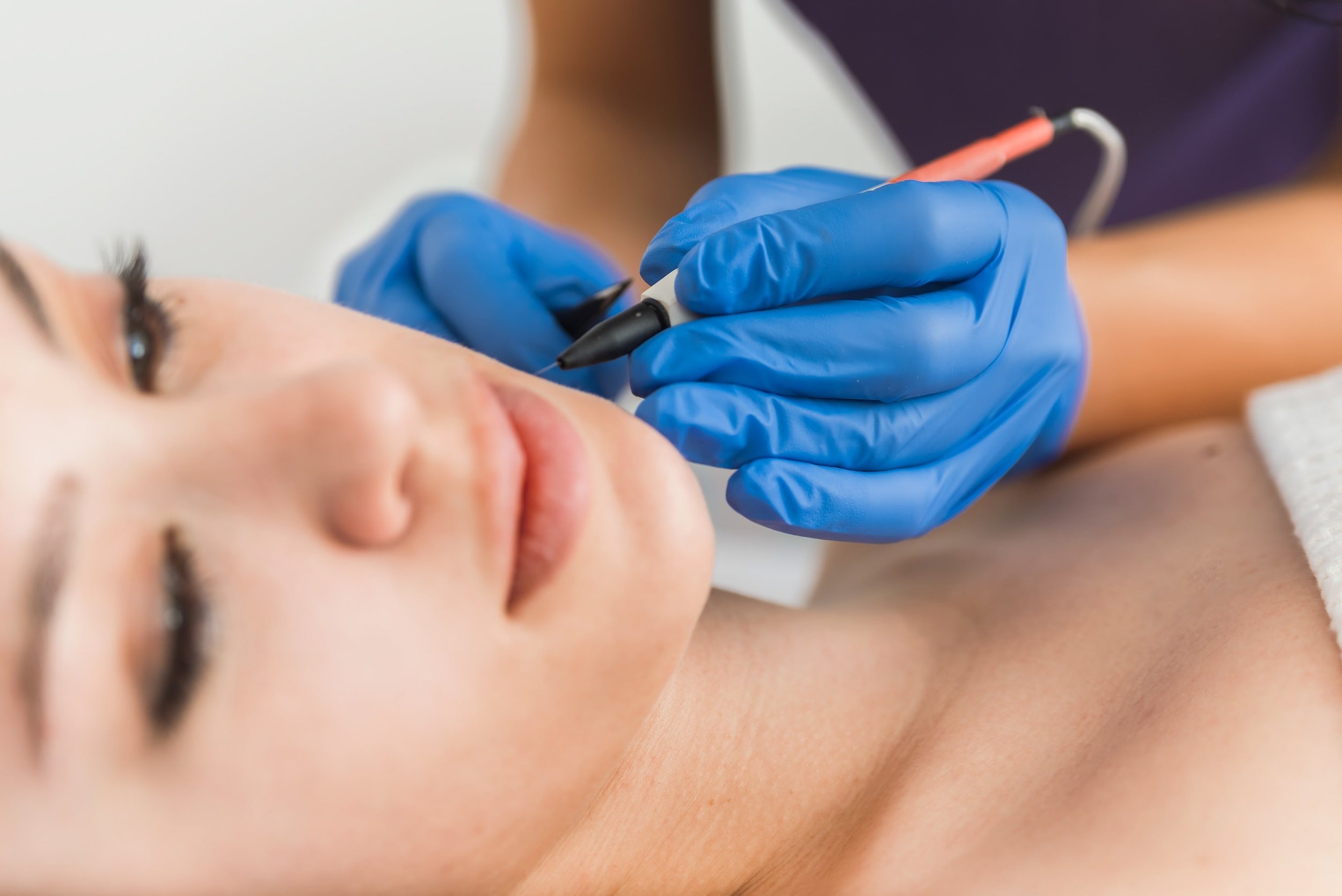 A person receiving a cosmetic or tattoo procedure on their face, with a practitioner wearing blue gloves using a fine-tipped tool near their eye.