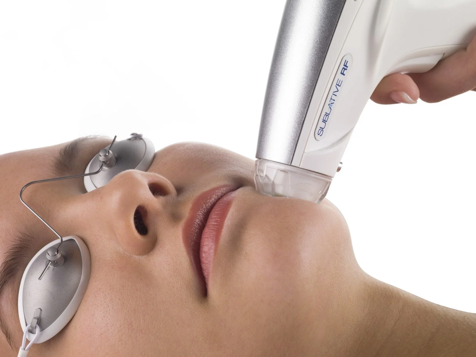 A person undergoing a cosmetic procedure with a device labeled 'SubtleLASE RF' on their face, wearing eye protection.