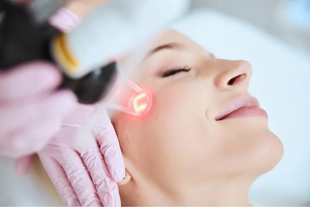 co2 laser resurfacing