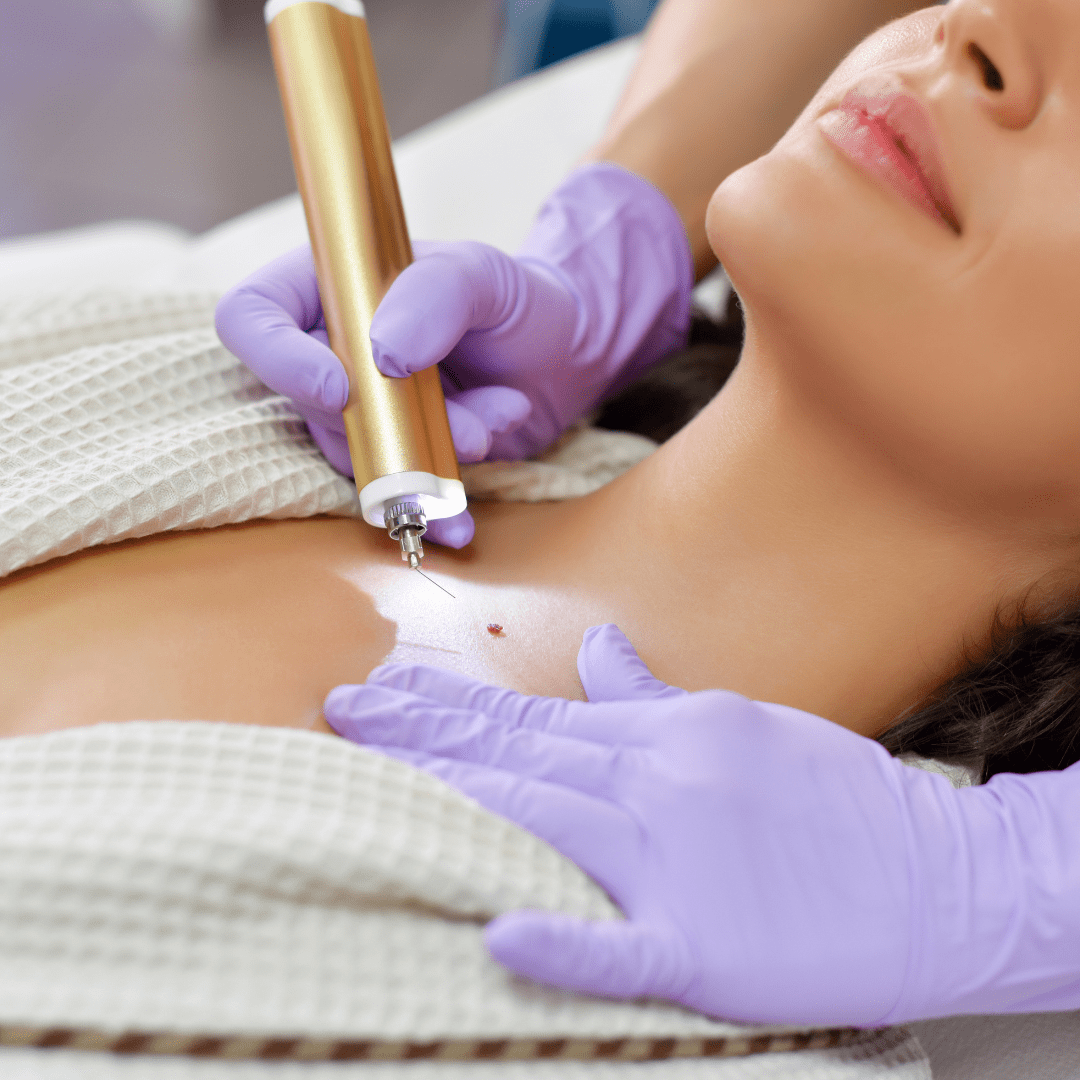 body treatments tampa