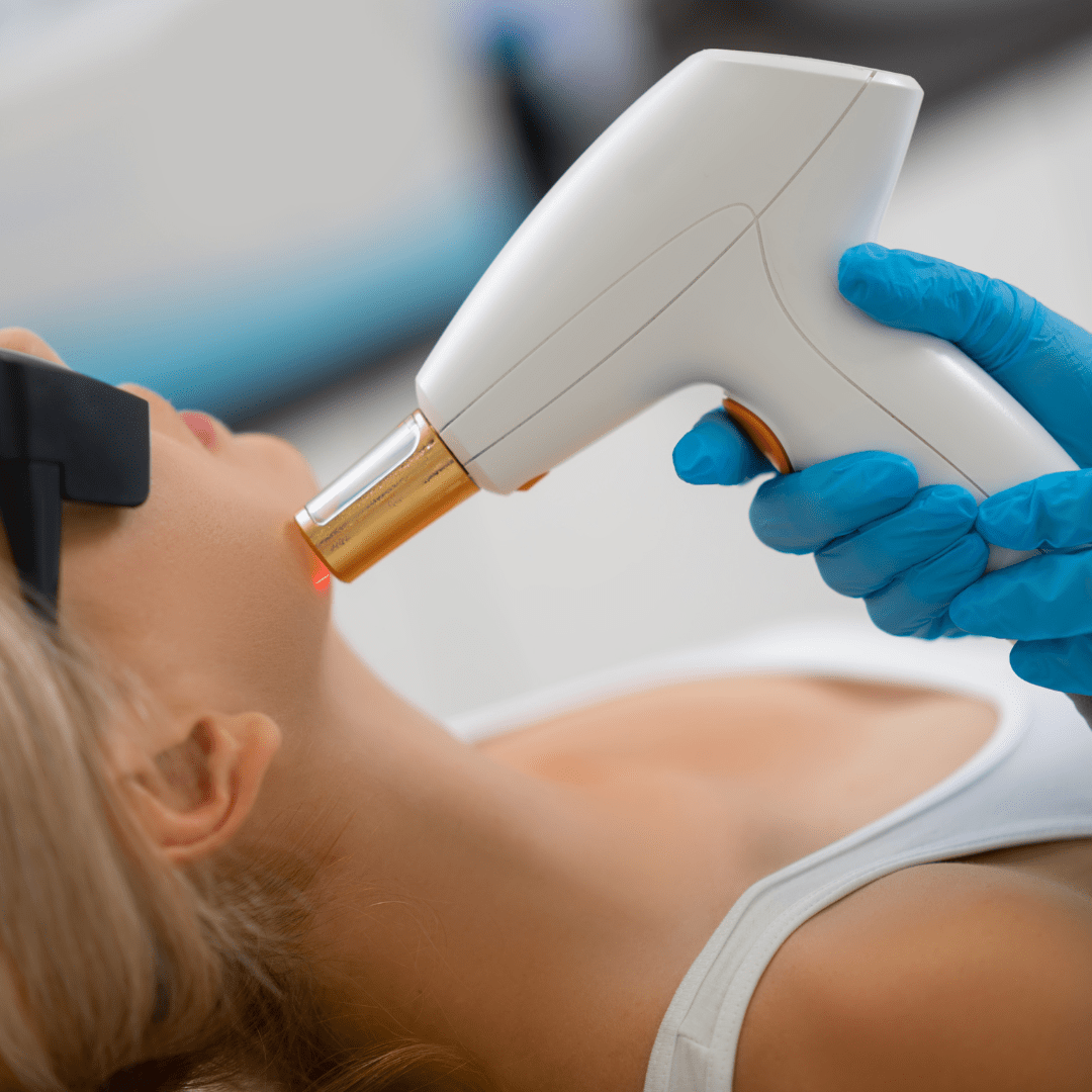 A woman receiving a laser treatment on her chin in a clinical setting, with a medical professional holding a laser device.