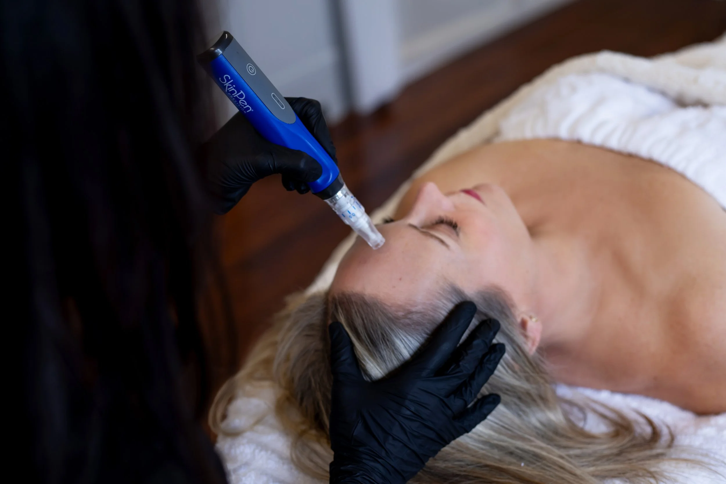 SkinPen treatment in Lexington MA