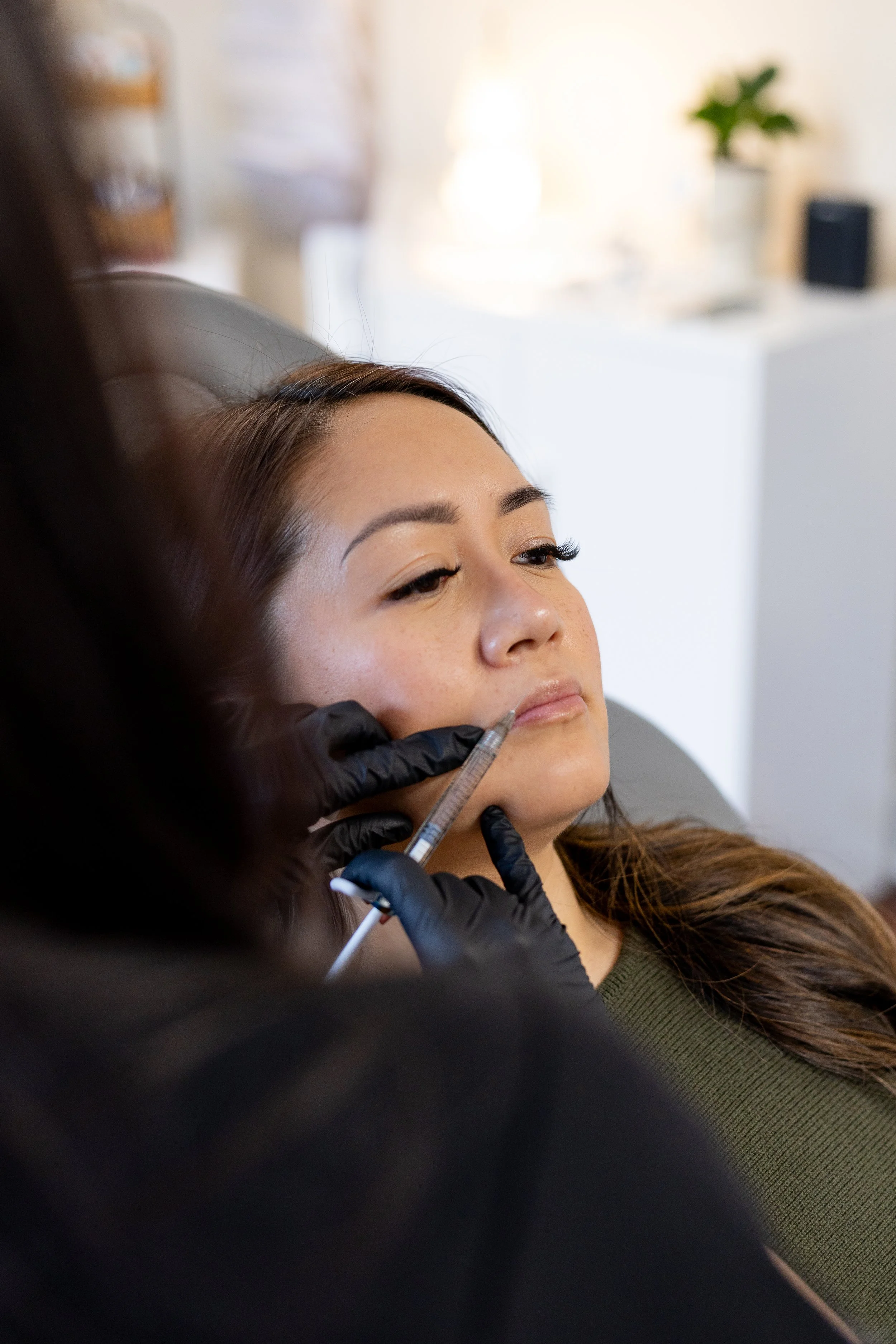 Best lip fillers in Lexington MA