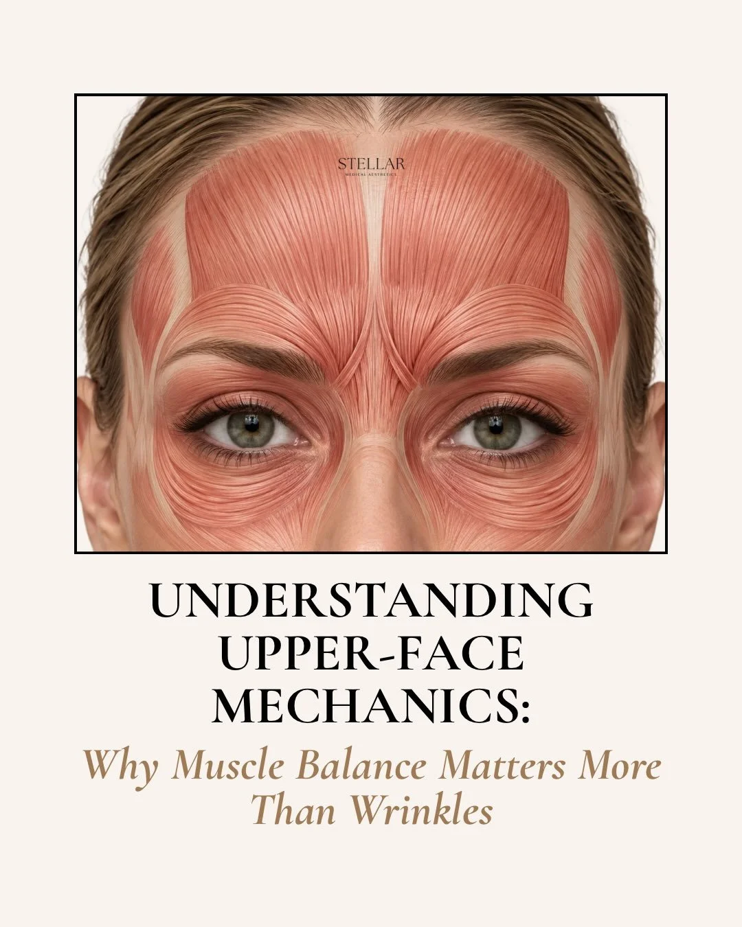 The upper face tells you a lot if you know how to read it.

Lines are only part of the story. The way the brows sit, how the eyes open, where movement is strongest, how the skin responds, and where volume has been lost all help show what should be so