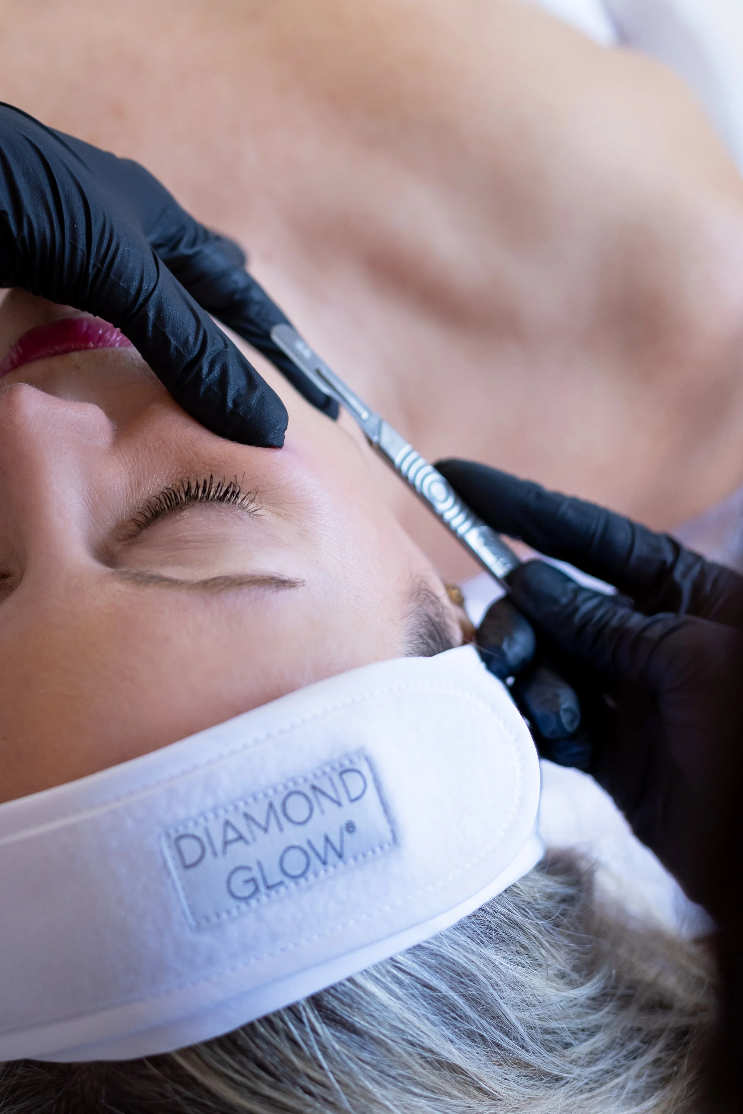 Dermaplaning in Lexington, MA