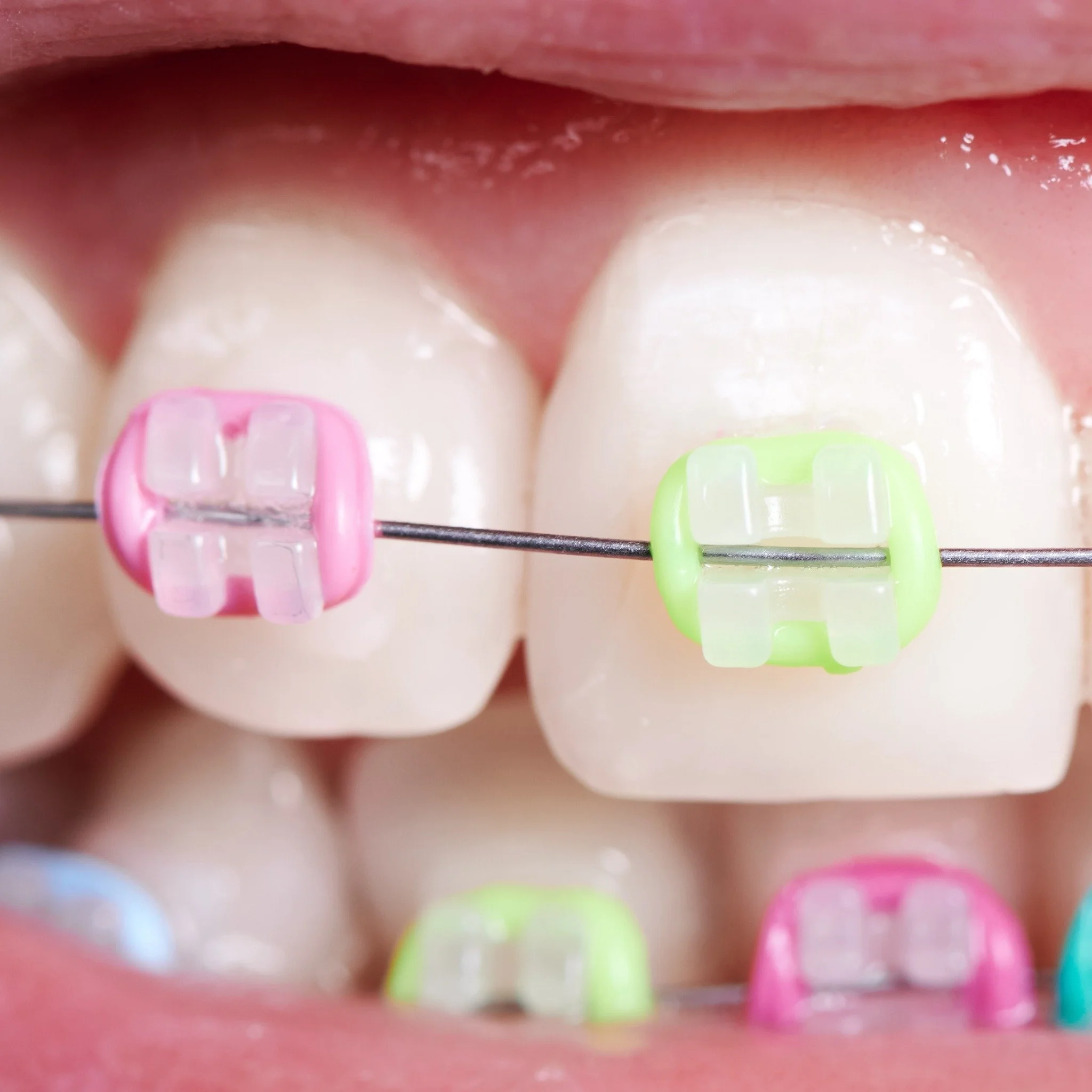 Reguleringsstrikker i regnbuens farger 🌈 #pride2024 #gladtannregulering #smile