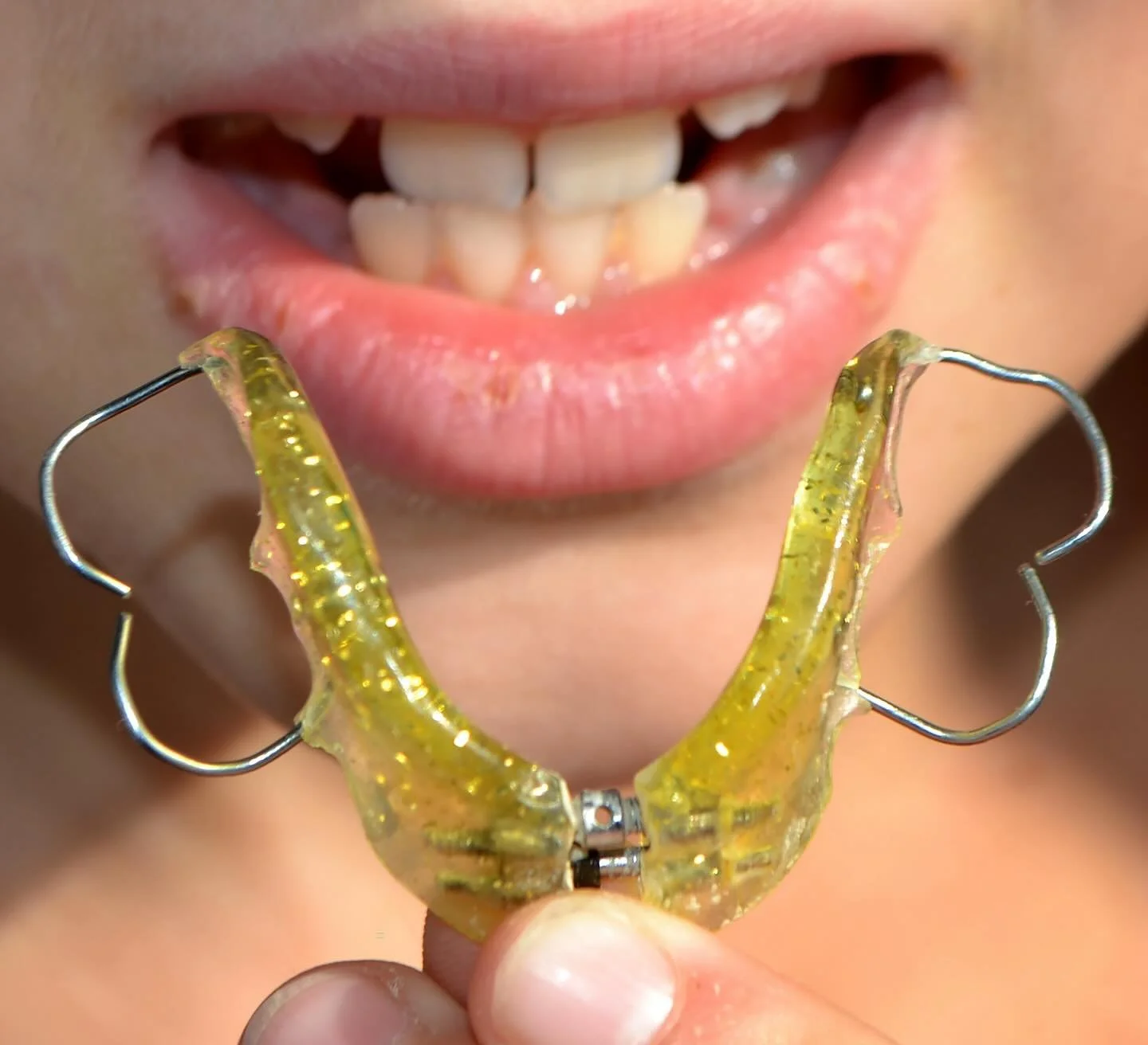 God hygiene er viktig for at gommen din skal holde seg ren og funksjonell. ✨ Husk &aring; rengj&oslash;r gommen daglig med en tannb&oslash;rste og mild s&aring;pe, f&oslash;r du skyller den godt med vann. Oppbevar den alltid i boksen sin. 🤗