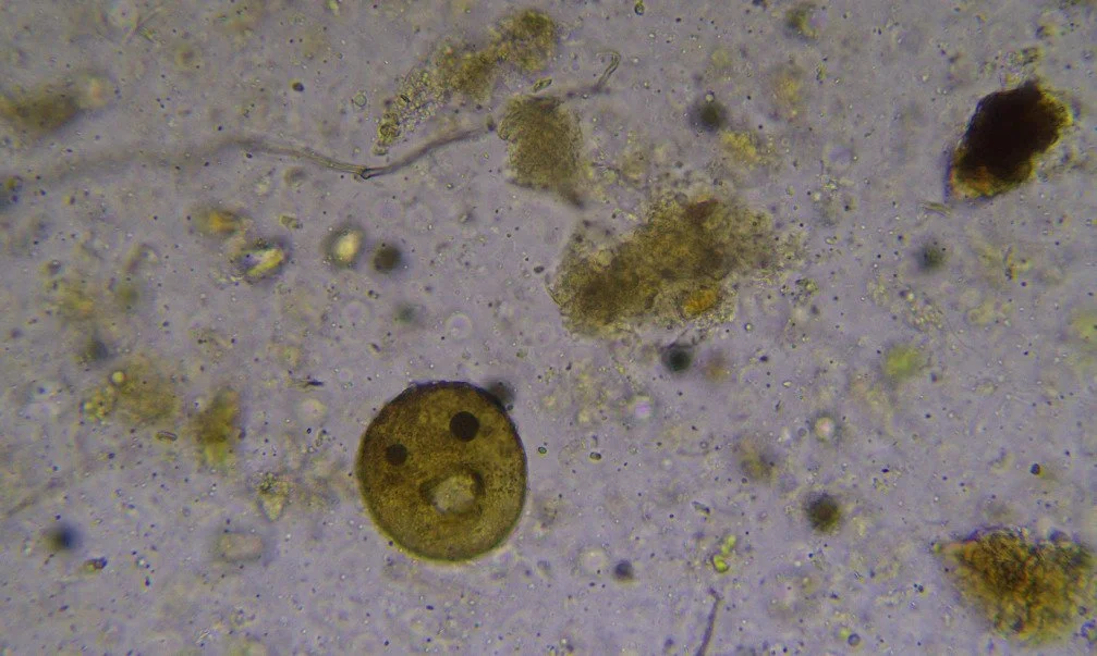 TestateAmoebae (1).jpg