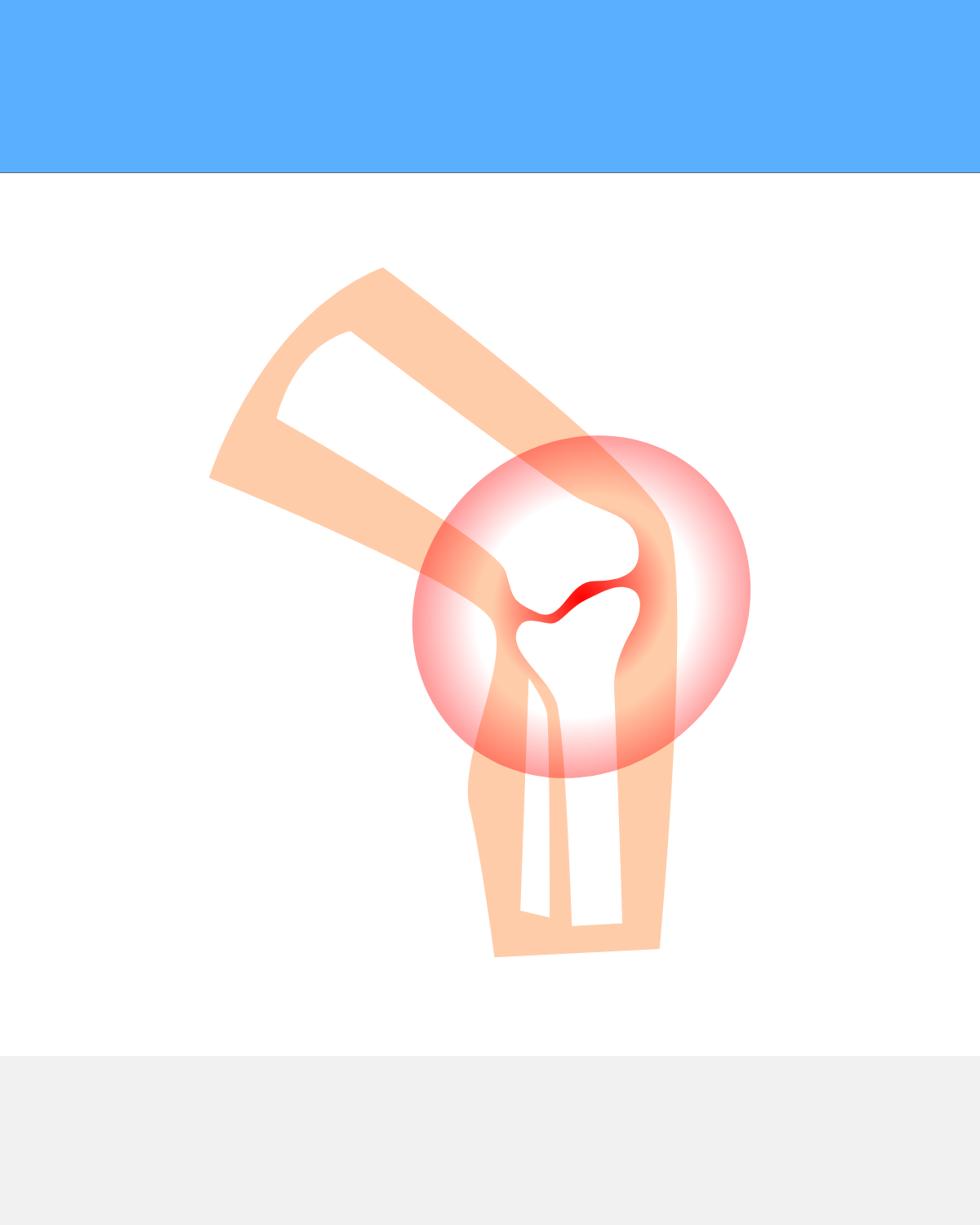 Knee Osteoarthritis Exercises: A 2-Week Starter Plan (No Deep Squats)
