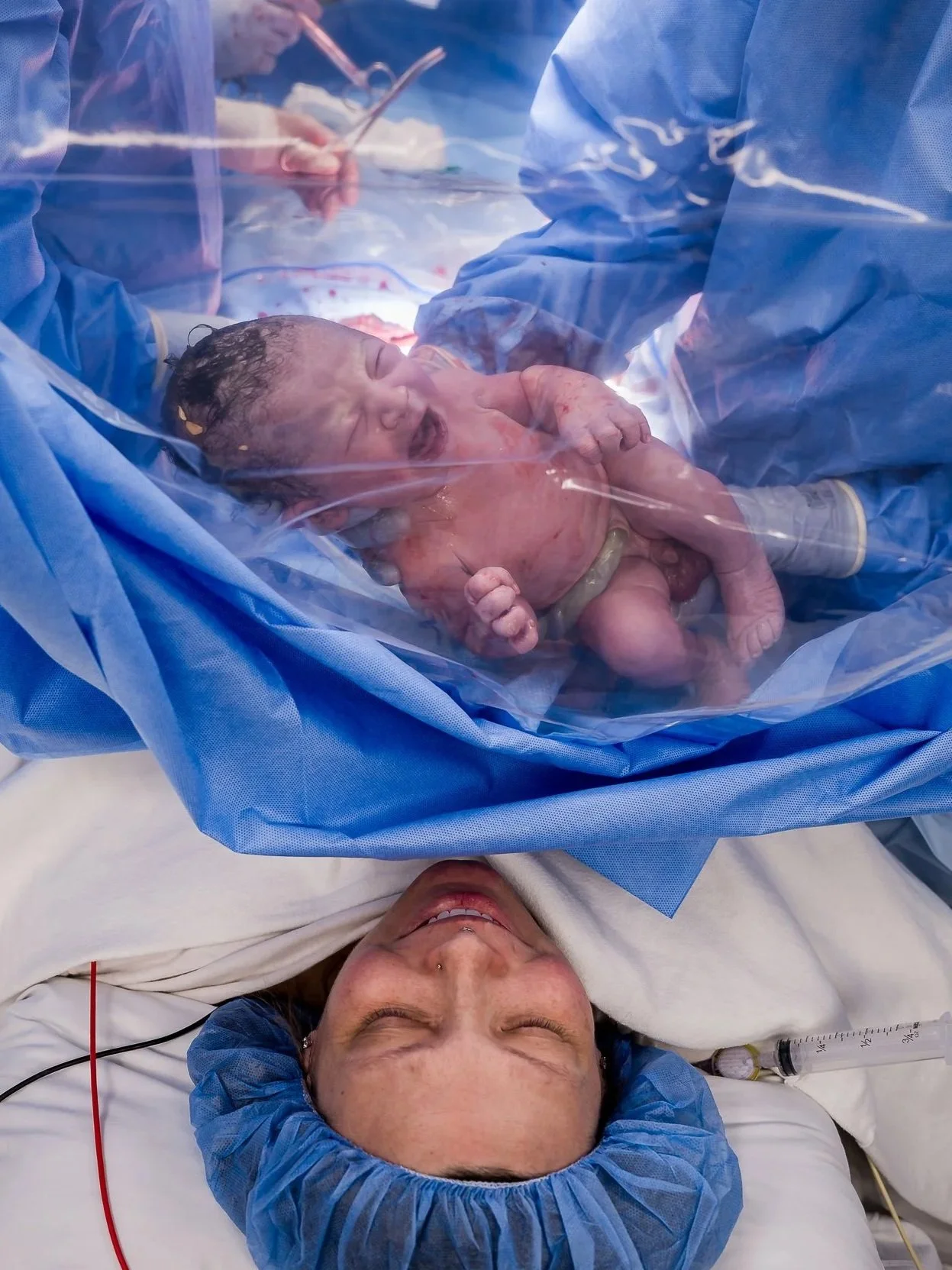 A newborn baby being delivered via cesarean section with medical staff in blue scrubs assisting, lying on a hospital bed with a woman in a blue cap and white gown, smiling with closed eyes.