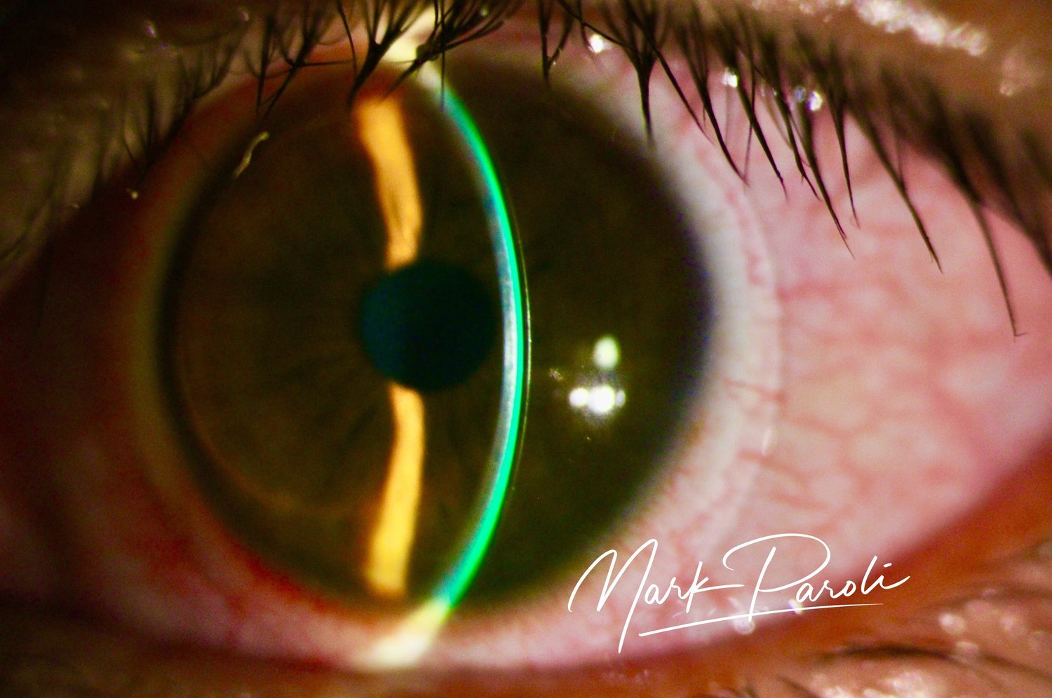 August 4, 2023 Scleral Lens fitting