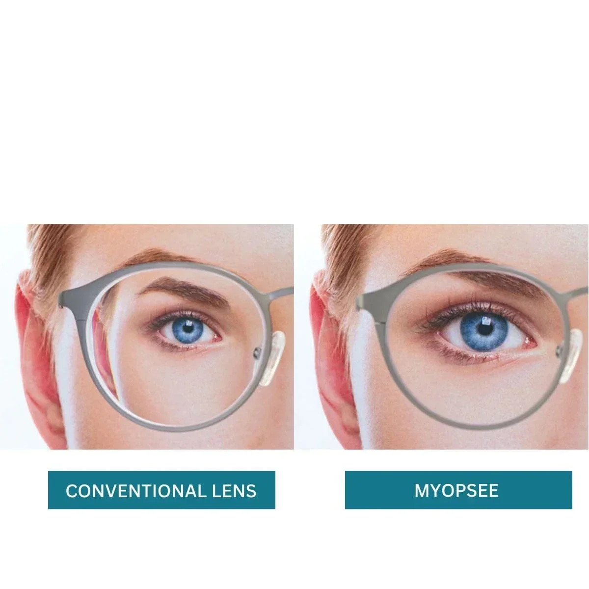 3 Expert Tips for Thin Lenses: Solutions for a High Eye Grade