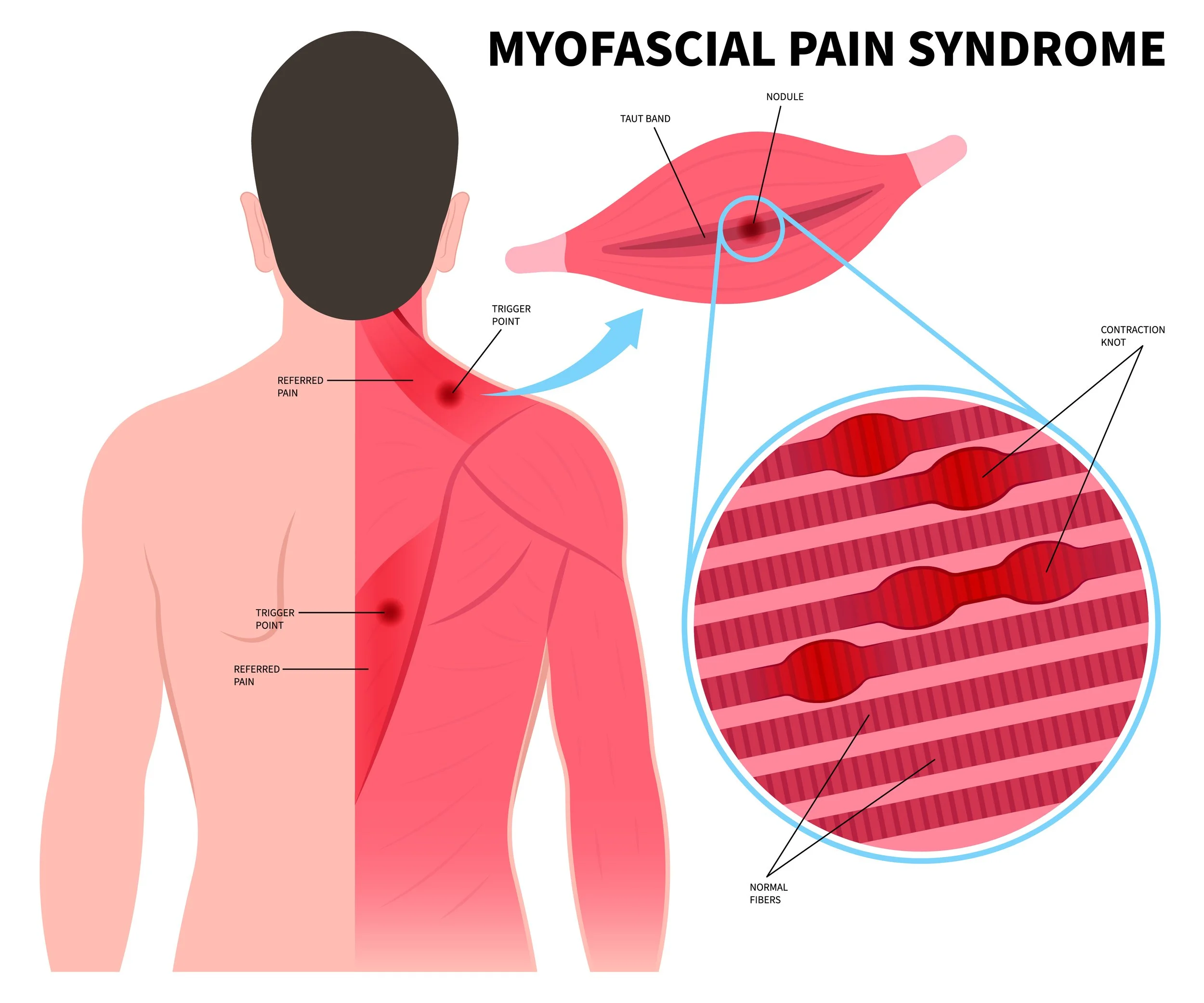 All Things Fascia:  The Interconnected System Between Your Muscles, Joints, Nerves and Organs