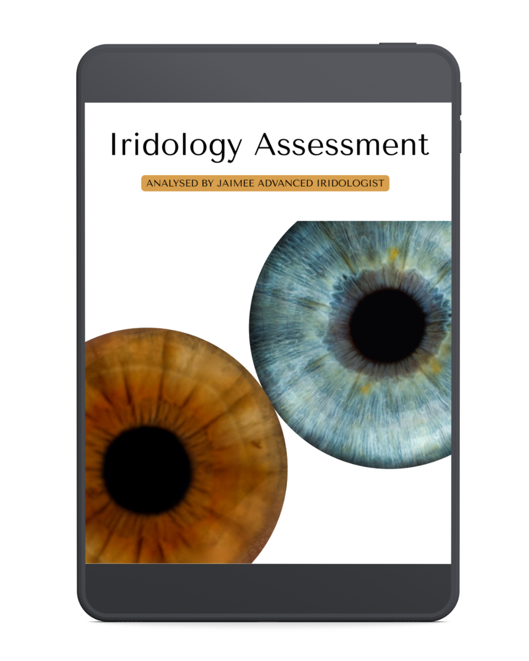 Online Iridology Assessment & Report