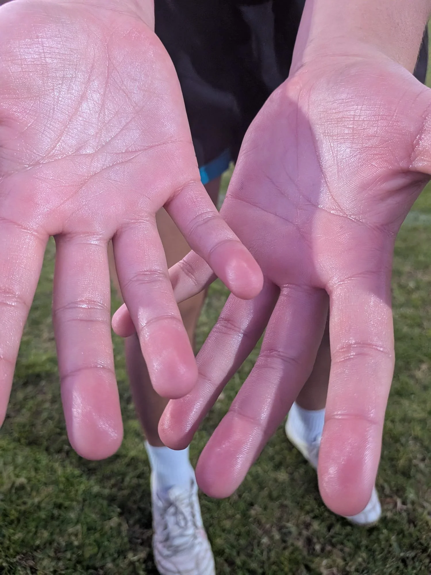 after spray on hands.jpeg
