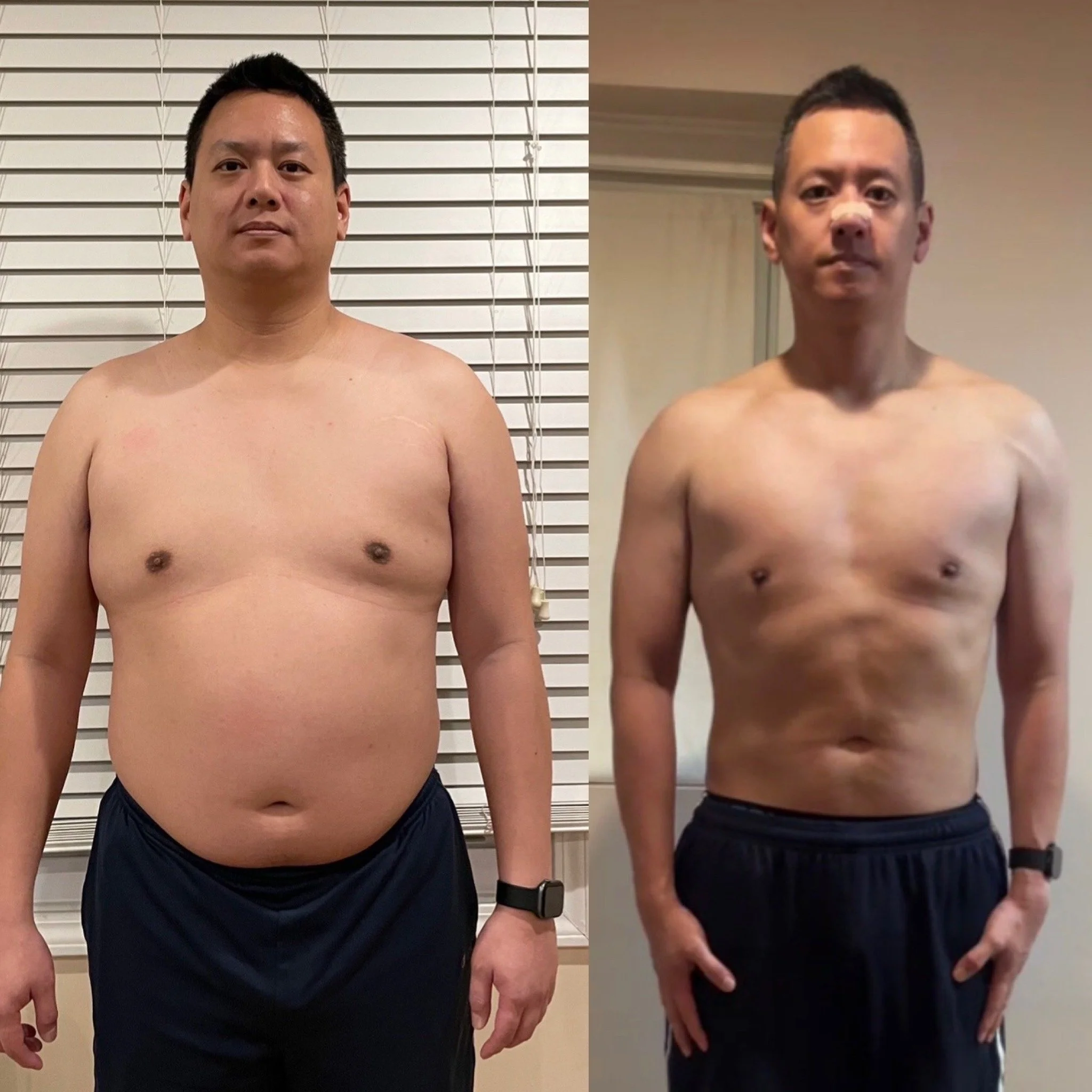 Comparison photo showing a man with light skin, short dark hair, shirtless, in front of a white background with blinds on the left and an indoor wall on the right, wearing a smartwatch on his left wrist and black shorts.