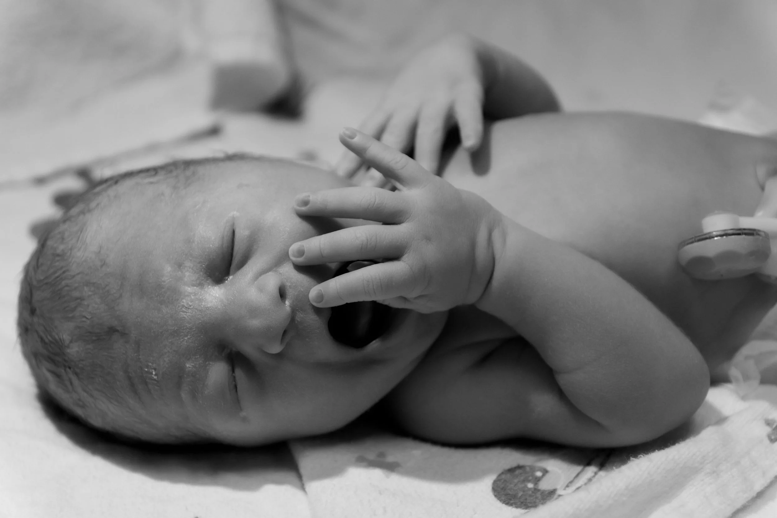 Newborn baby with eyes closed, yawning, lying on a blanket, with an oxygen sensor attached to its chest.