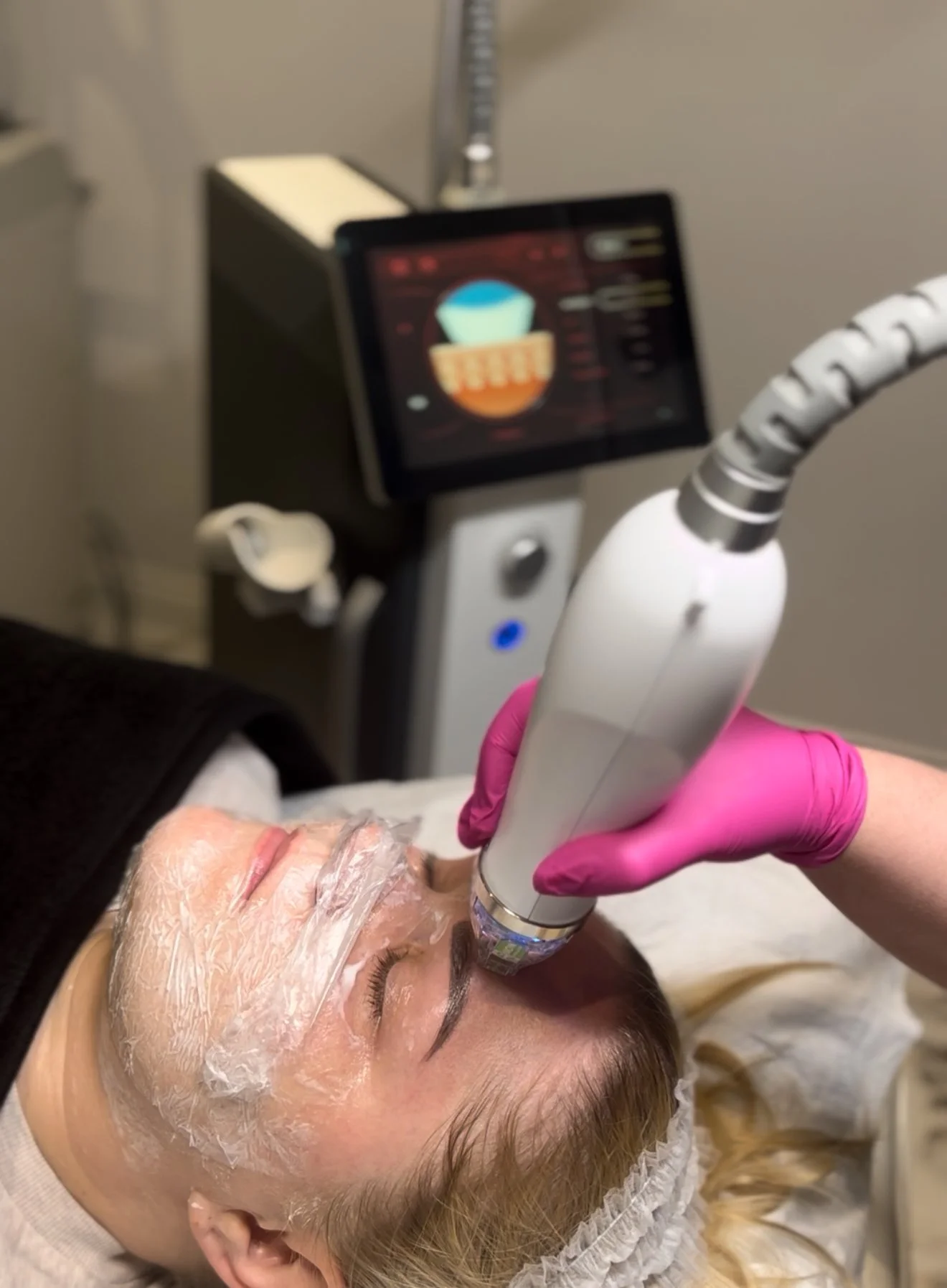 A woman receiving a facial treatment with a handheld device at a spa or skincare clinic, with a technician wearing pink gloves applying the device to her forehead while she is lying down with a shower cap and a facial mask.