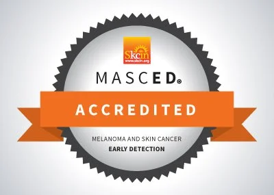 Skin Cancer Screening Livingston , Mid Calder, East Calder , West Lothian